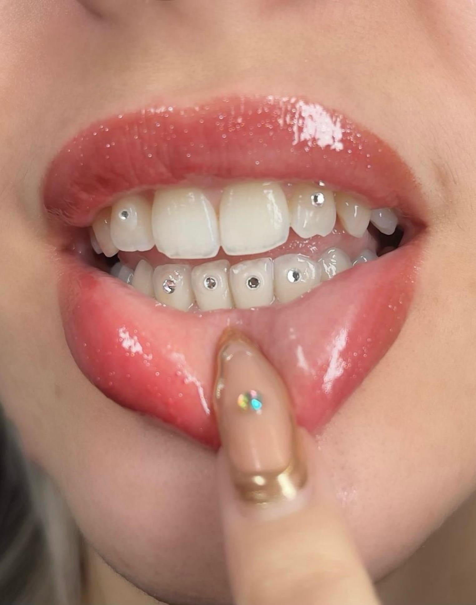 Gemas Dentales Badalona