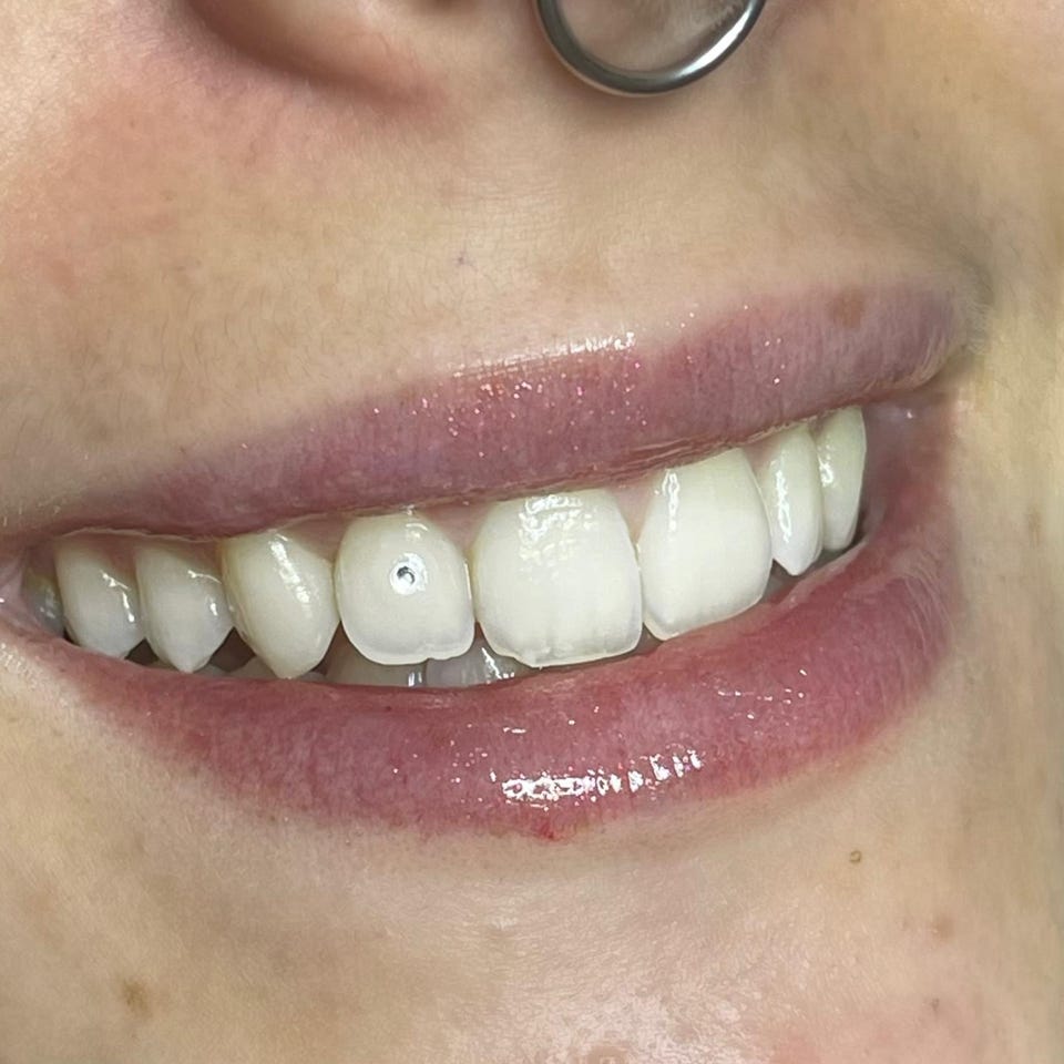 Gemas dentales en Badalona. Dale un toque de brillo y personalidad a tu sonrisa con total seguridad.