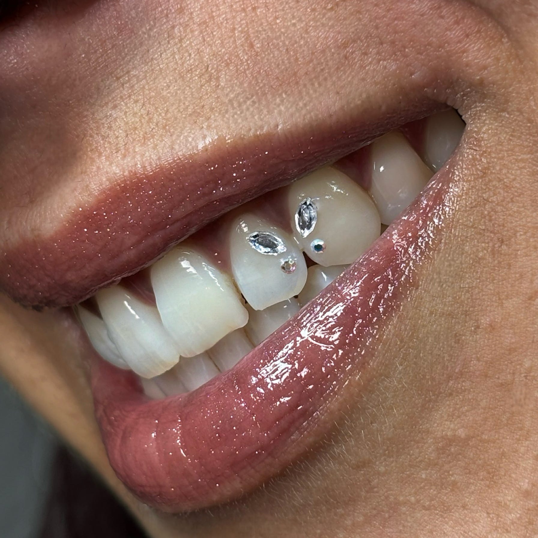 Gemas dentales en Badalona. Dale un toque de brillo y personalidad a tu sonrisa con total seguridad.